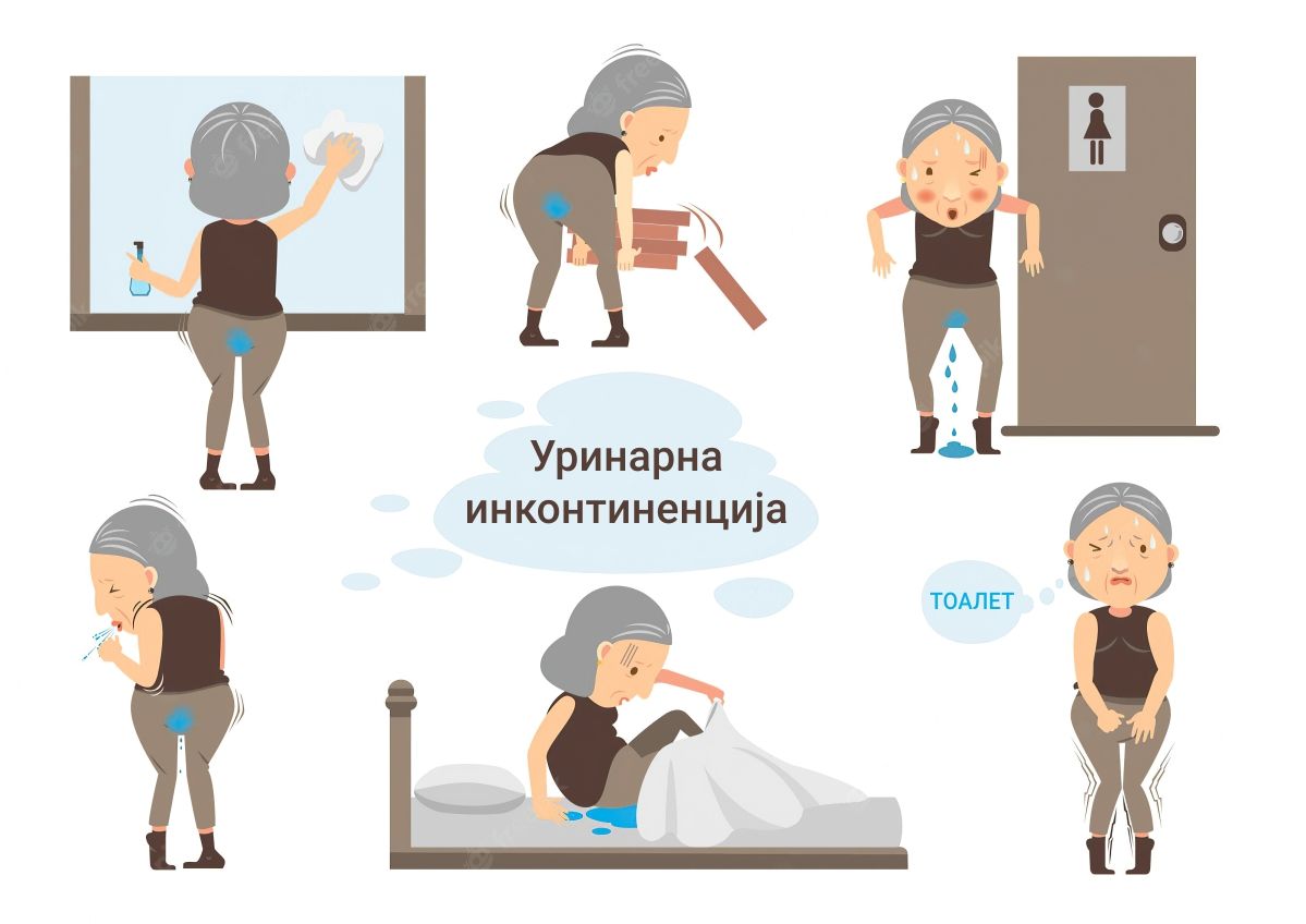 Како да живеете подобро со уринарна инконтиненција?