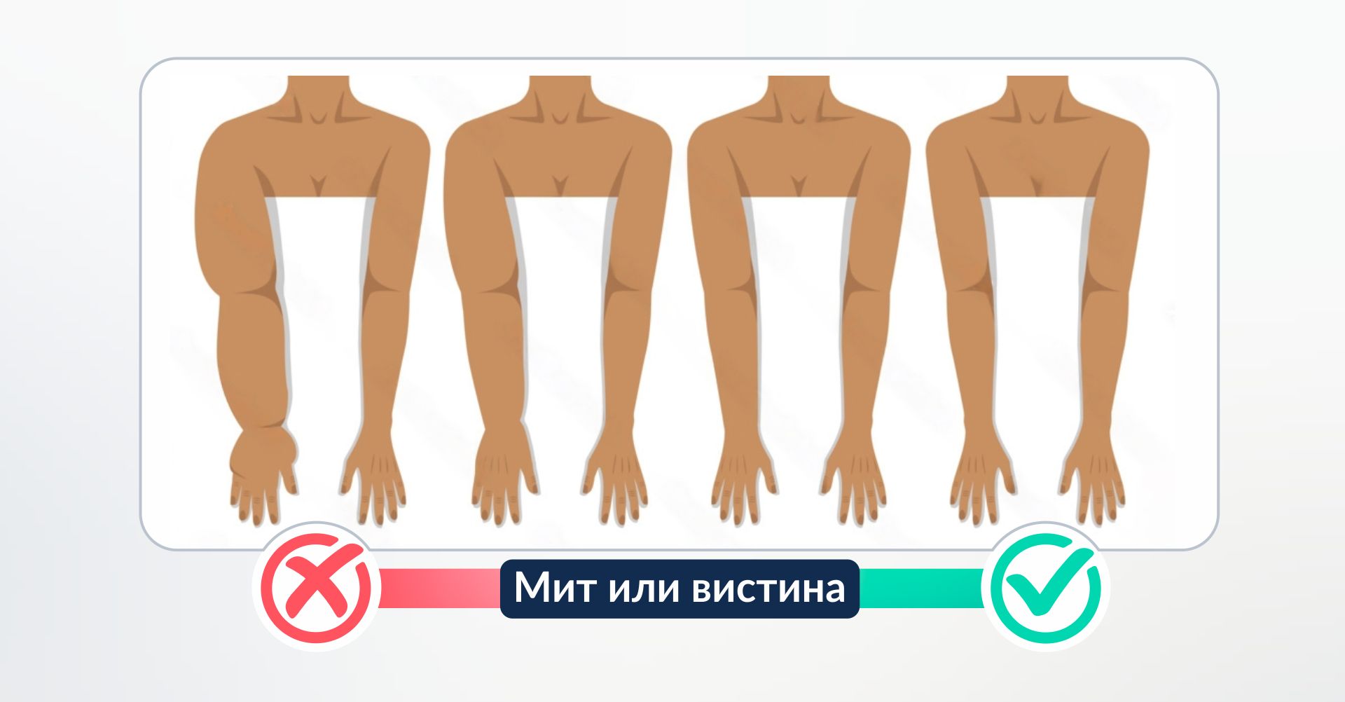 Мит или вистина за лимфедема